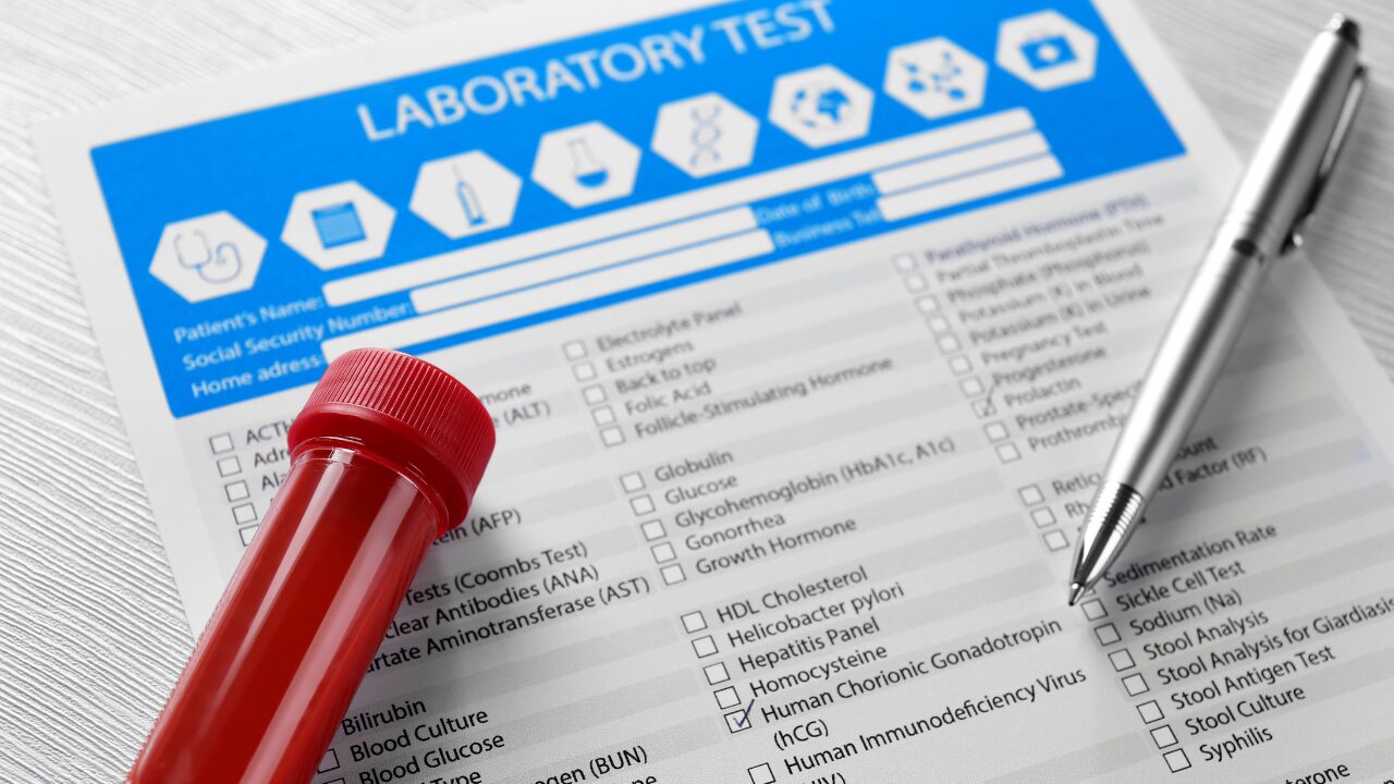 laboratory tests